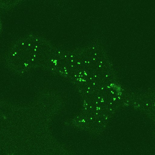 Rat siayl transferase signal anchor sequence- GFP in leaf epidermal cells